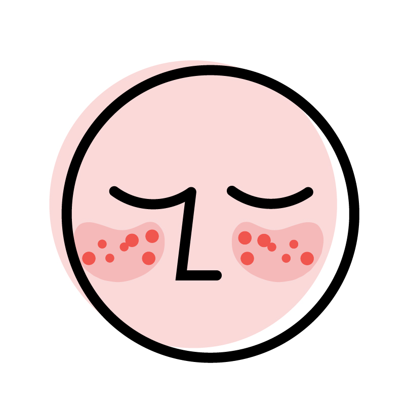 Simple illustration of a round face with closed eyes and red spots on the cheeks, suggesting skin irritation or acne.