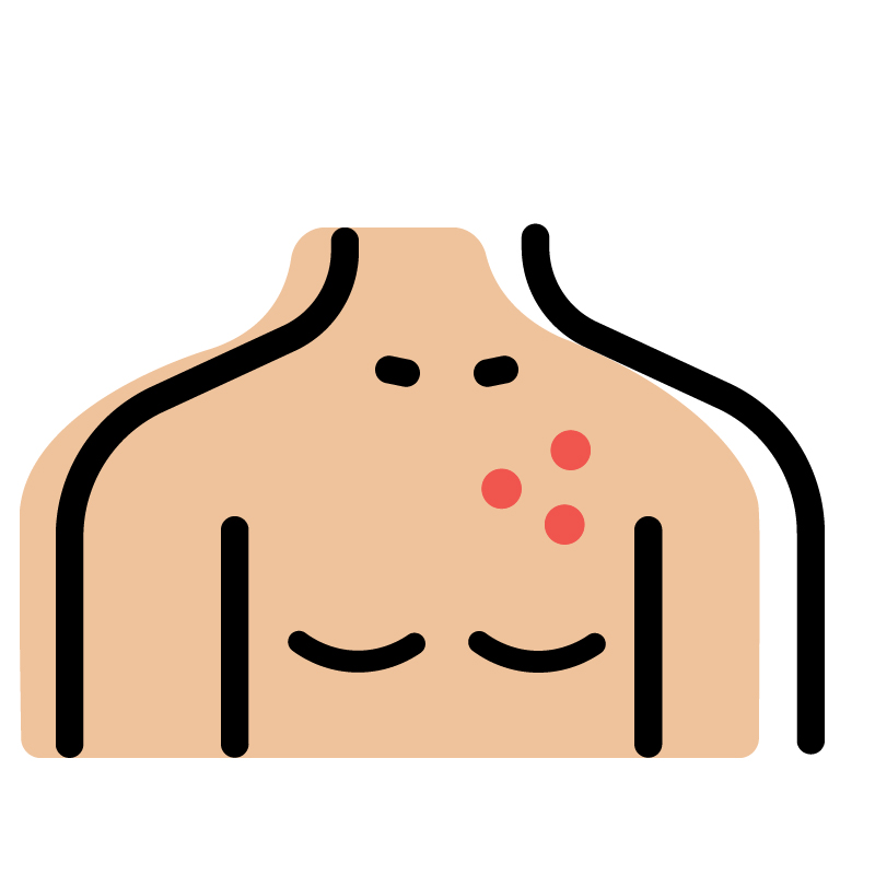 Illustration of a human torso with three red spots on the skin, possibly indicating acne or a rash.