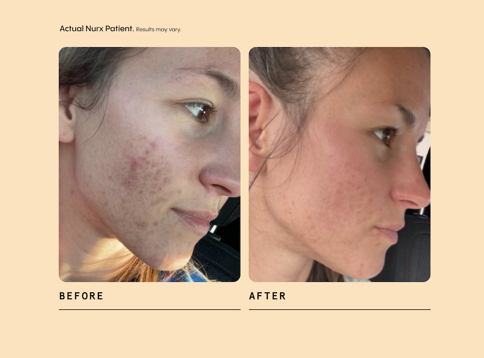 Image illustrating 'The results are real'