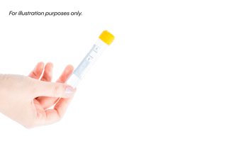 A hand holds a clear test tube with a yellow cap against a white background.