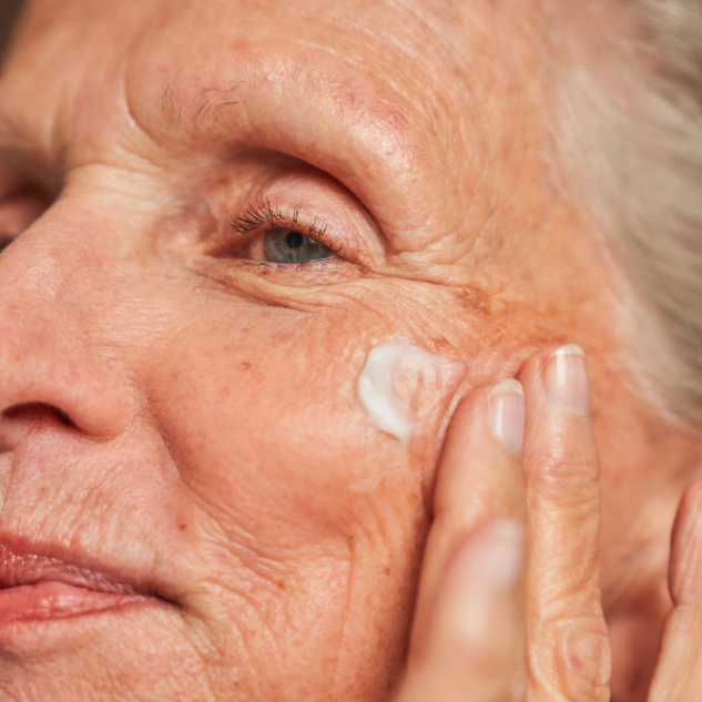 Close-up of an older person applying hydroquinone cream to their face, focusing on the eye area and highlighting the skin texture.