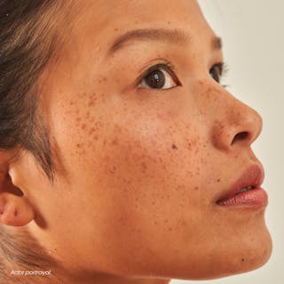 Nurx Dark Spots Formula-Product-Image-Desktop-633×633-2